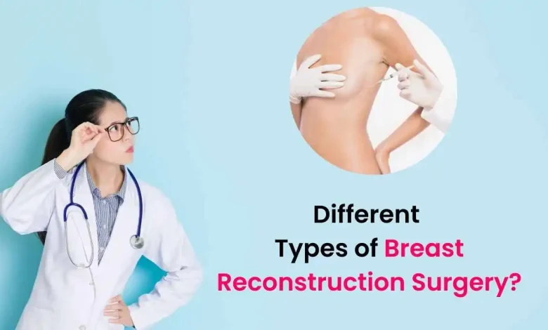 Breast Reconstruction: Treatment Options Post Mastectomy